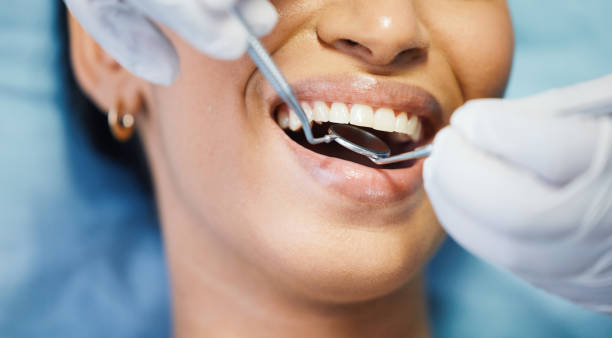 Best Emergency Dental Care for Abscessed Tooth in Cartersville, GA