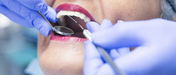 Best Orthodontic Emergency Dentist in Cartersville, GA